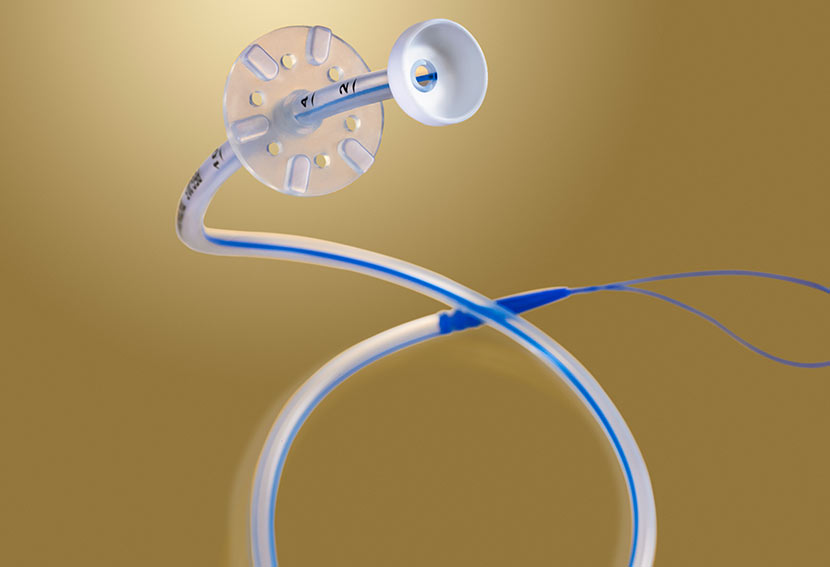 GASTROSTOMIA PERCUTANEA ENDOSCOPICA – PEG
